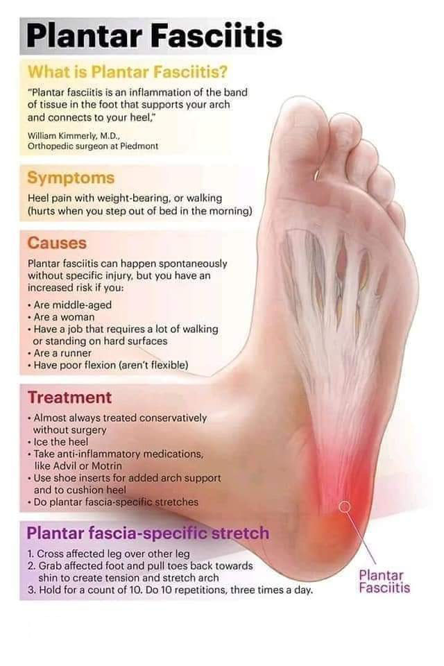 Plantar Info 2